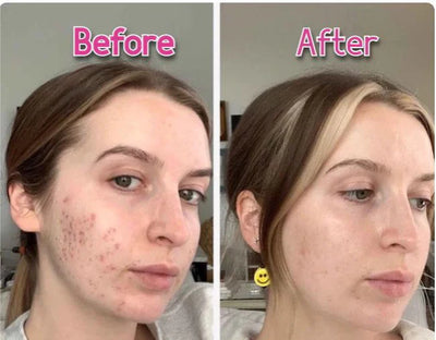 LED Face & Neck Wrinkle Massager 7-in-1 Facial LED Sculptor