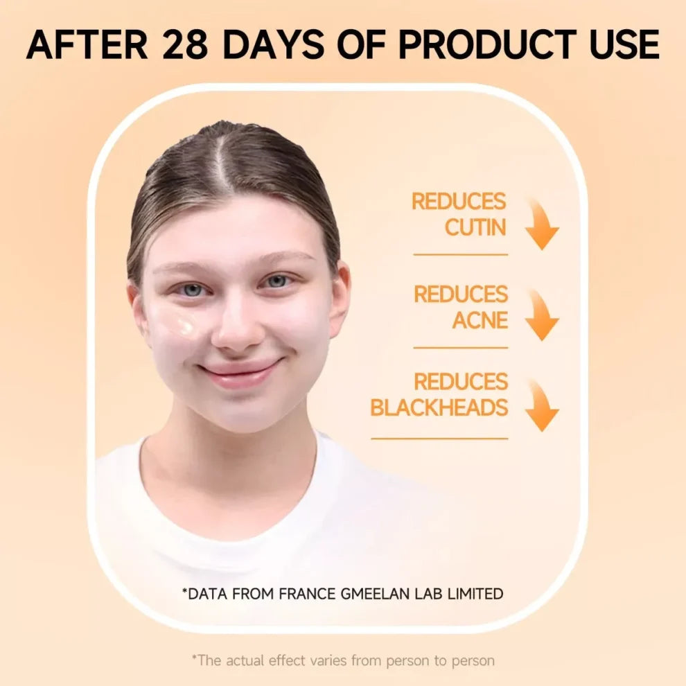 Orange Exfoliating Whitening Gel