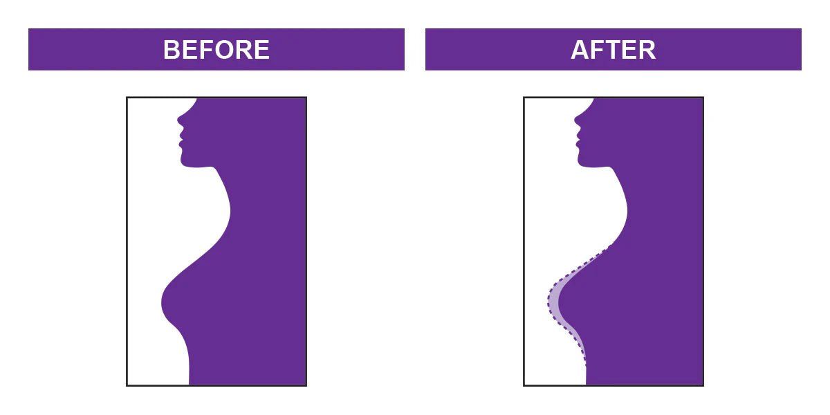 Shape Up Natural Breast Enlargement Cream