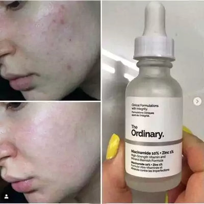 Minisouk-The Ordinary Niacinamide