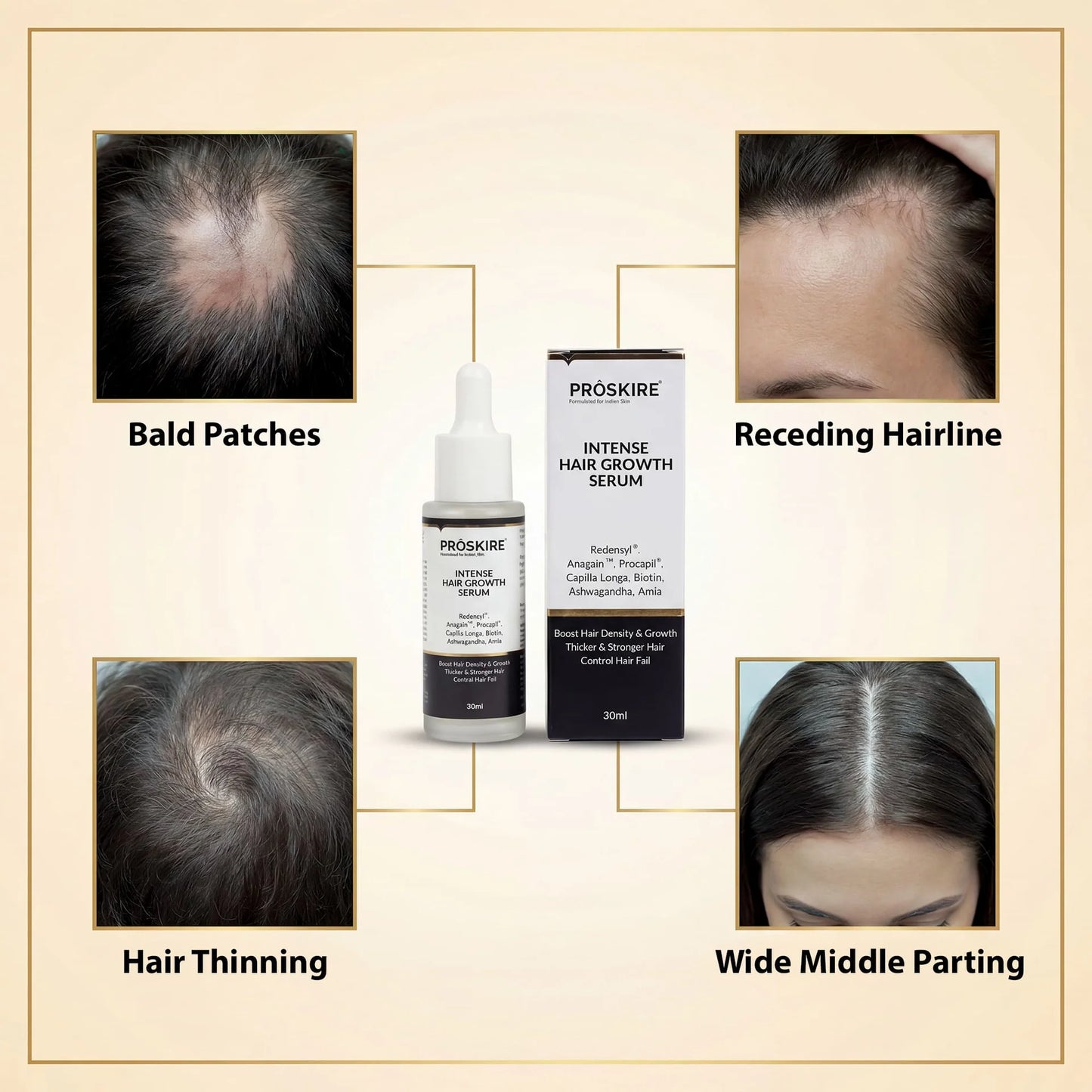 PROSKIRE Intense Hair Growth Serum hair regrowth solution for men and women experiencing hair thinning, reduced density, bald patches, or receding hairlines.