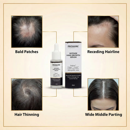 PROSKIRE Intense Hair Growth Serum hair regrowth solution for men and women experiencing hair thinning, reduced density, bald patches, or receding hairlines.
